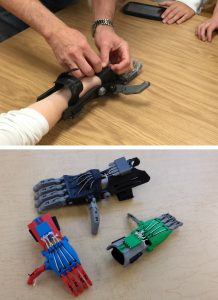 3D printed arms from Gettys MS